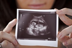 Abortion Activists Admit: "I Knew It Was a Baby" | LifeNews.com
