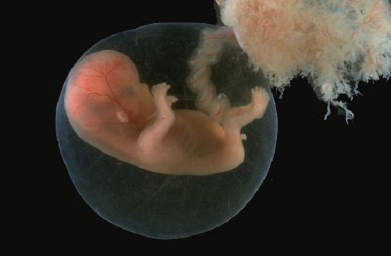 Amazing Fetal Development Photos Confirm Human Life Begins at Conception  LifeNews.com