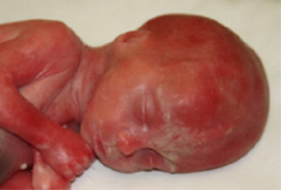 Imagini pentru 766 Babies in Canada Born Alive After Failed Abortions and Left to Die