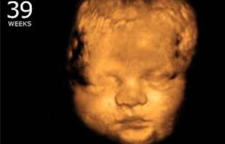 Killing Babies in Abortions is Not the Answer to “Climate Change”