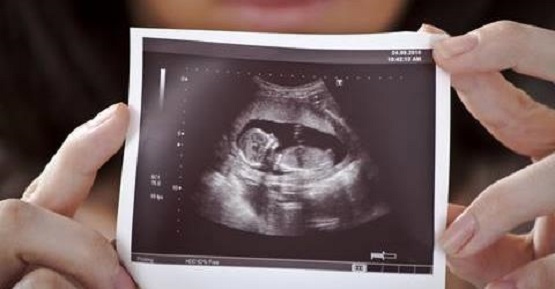 Abortion Activists Hate Ultrasounds Because If Mothers See Their Baby, They’ll Reject Abortion