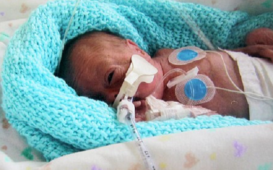 35 States Allow Babies Born Alive After a Botched Abortion to be Left to Die