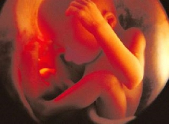 Pro-Life Leader Says Congress and States Must Both Protect Babies From Abortions