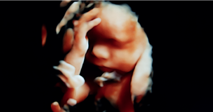 Vermont Passes Constitutional Amendment Legalizing Killing Babies in Abortions Up to Birth