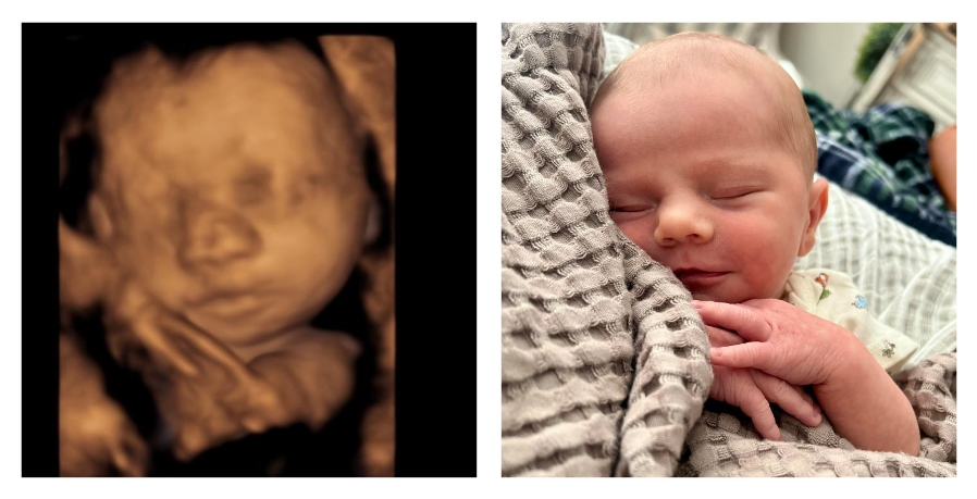 Florida Heartbeat Law is Saving 300 Babies From Abortion Every Month