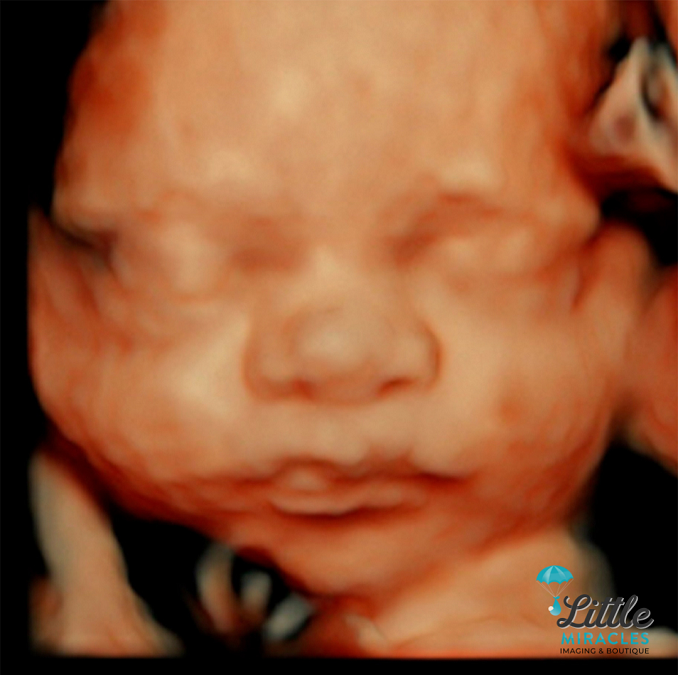Feed Image